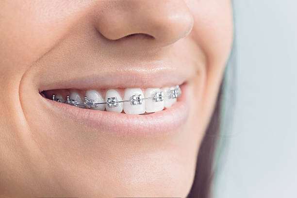 Best Invisalign and Clear Aligners  in Park Hill, OK